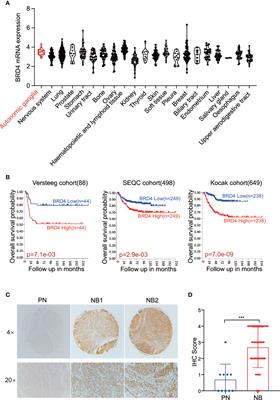 PROTAC Bromodomain Inhibitor ARV-825 Displays Anti-Tumor Activity in Neuroblastoma by Repressing Expression of MYCN or c-Myc